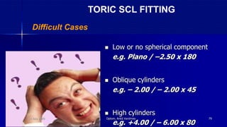  Low or no spherical component
e.g. Plano / –2.50 x 180
 Oblique cylinders
e.g. – 2.00 / – 2.00 x 45
 High cylinders
e.g. +4.00 / – 6.00 x 80
Difficult Cases
TORIC SCL FITTING
14 July 2020 Optom. Ankit Varshney 79
 