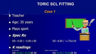  Teacher
 Age: 35 years
 Plays sport
 Spec Rx
OD –5.00 / –2.00 x 80 OS –6.00 / –1.75x110
 K readings
OD 44.00 / 43.50@ 90 OS 43.50 / 43.00@ 95
Case 1
TORIC SCL FITTING
14 July 2020 Optom. Ankit Varshney 80
 