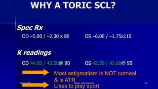 WHY A TORIC SCL?
Spec Rx
OD –5.00 / –2.00 x 80 OS –6.00 / –1.75x110
K readings
OD 44.00 / 43.50@ 90 OS 43.50 / 43.00@ 95
Most astigmatism is NOT corneal
& is ATR
Likes to play sport
14 July 2020 Optom. Ankit Varshney 83
 