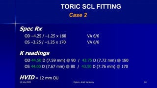Spec Rx
OD –4.25 / –1.25 x 180 VA 6/6
OS –3.25 / –1.25 x 170 VA 6/6
K readings
OD 44.50 D (7.59 mm) @ 90 / 43.75 D (7.72 mm) @ 180
OS 44.00 D (7.67 mm) @ 80 / 43.50 D (7.76 mm) @ 170
HVID = 12 mm OU
Case 2
TORIC SCL FITTING
14 July 2020 Optom. Ankit Varshney 84
 