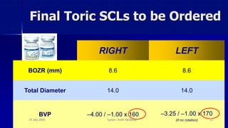 RIGHT LEFT
BOZR (mm) 8.6 8.6
Total Diameter 14.0 14.0
BVP –4.00 / –1.00 x 160 –3.25 / –1.00 x 170
(if no rotation)
Final Toric SCLs to be Ordered
14 July 2020 Optom. Ankit Varshney 88
 