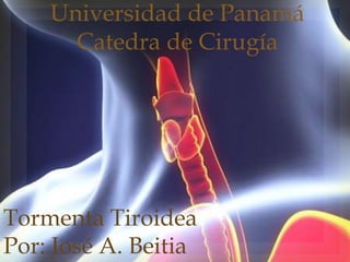 Universidad de Panamá
Catedra de Cirugía
Tormenta Tiroidea
Por: José A. Beitia
 