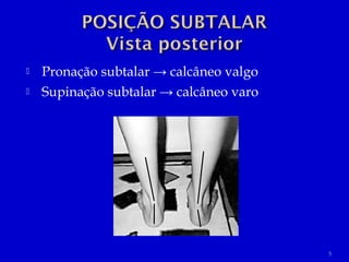  Pronação subtalar → calcâneo valgo
 Supinação subtalar → calcâneo varo
5
 