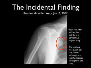 "Gimme my damn data!" - e-Patient Dave's keynote at Medicine 2.0 2009