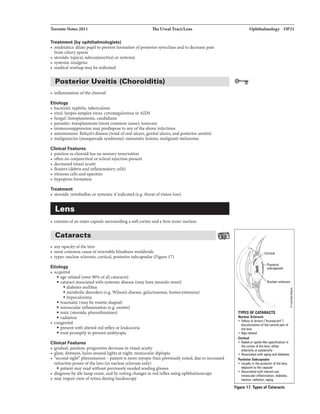 Toronto Notes 2011 The Uveal Tract/Lens
Treatment {by ophthalmologists)
• mydriatks: dilate pupilto prevent fonnation ofposterior synechiae and to decrease pain
from ciliary spasm
• steroids: topical, subconjunctival or systemic
• systemic analgesia
• medical workup may be indicated
Posterior Uveitis (Choroiditis)
• inflammation ofthe choroid
Etiology
• bacterial: syphilis, tuberculosis
• viral: herpes simplex virus, cytomegalovirus in AIDS
• fungal: histoplasmosis, candidiasis
• parasitic: toxoplasmosis (most common cause), toxocara
• immunosuppression may predispose to anyofthe above infections
• autoimmune: Beh¢s disease (triad oforal ulcers, genital ulcers, and posterior uveitis)
• malignancies (masquerade syndrome): metastatic lesions, malignant melanoma
Clinical Features
• painless as choroid has no sensory innervation
• often no conjunctival or scleral injection present
• decreased visual acuity
• floaters (debris and inflammatory cells)
• vitreous cells and opacities
• hypopyon formation
Treatment
• steroids: retrobulbar or systemic ifindicated (e.g. threat ofvision loss)
Lens
• consists ofan outer capsule surrounding a soft cortex and a firm inner nucleus
Cataracts
• any opacity ofthe lens
• most common cause ofreversible blindness worldwide
• types: nuclear sclerosis, cortical, posterior subcapsular (Figure 17)
Etiology
• acquired
• age-related (over 90% ofall cataracts)
• cataract associated with systemic disease (may have juvenile onset)
• diabetes mellitus
• metabolic disorders (e.g. Wilson's disease, galactosemia. homocystinuria)
• hypocalcemia
• traumatic (may be rosette shaped)
• intraocular inflammation (e.g. uveitis)
• toxic (steroids, phenothiazines)
• radiation
• congenital
• present with altered red reflex or leukocoria
• treat promptlyto prevent amblyopia
Clinical Features
• gradual, painless, progressive decrease in visual acuity
• glare, dimness, halos around lights at night, monocular diplopia
• "secondsight" phenomenon - patient is more myopic than previously noted, due to increased
refractive power ofthe lens (in nuclear sclerosis only)
• patient may read without previously needed reading glasses
• diagnose by slit-lamp exam, and bynoting changes in red reflex using ophthalmoscope
• may impair view ofretina during fundoscopy
Ophthalmology OP21
Posterior
subcapsular
Nudear sclerosis
(._jC.:.
TYPES OF CATARACTS
Nuclur Sclerosis
• Yallow ID brown l"brwlascent1
discoloLnlion of the central part of
1ha lens
• Aae-rallll&d
• Radial or spok&-likll opacification in
1ha cortBX ofthe luns, eilhar
antariorly or posteriorly
• Associated with aging 111d diabetes
Posterior Sullcap•ul•
• Usually inthe posterior of the lens,
adjacentIDthe c11psule
• Associlltad with steroid use,
intraocular inflammation, diabetn,
trauma. radiation. aging
Figure 17. Types of Cataracts
i
.!!
0
 