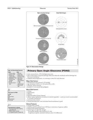 OP28 OphthalmoloBf
a.....-....c........... ..
PClAG PACB
• CommDn (9ft) • Rlre
• Qnnic ca.11e • Acute Ol'llet
• I'Ull-&yll • l'li1fiJ red aya
withoutra- • Exlmlaly1'lOP
• MDderatllly1' lOP • HIIZV l*llBI
• Nonnal cornea • Mid-dild8d
and pupil pi4Ji ......:tiva
• No fW tD light
• No halouruund • ± HIV.
lllldomilal pain
• H11D11nmd
light
llllkFHIIIn fir POA&
AFOO
Age
Frnily Hillury
lOP
Nric11 delclllll
11*1 Camaa
;b
Collnll'lllcdiiW_, Dlldla
• NelnlogiCIIIIbnormality
pupl a111111111ant
• ShallowIIIIWiorchlmber
• lriwupporltciiiiiWiorchlmberiOL
Glaucoma 1'oroDio 2011
o,tlc nern bHd dlmaga VIsual flllll chiiiD
Small pll'aCan1niiiCO!oml
Ara.llla dafact
cenlnll island
f"IG•ra 19. GlaucDJnllblua Damage
Primary Open Angle Glaucoma (POAG)
• most commonform, >9596 ofall glaucoma cases
• dueto obstruction ofaqueous drainagewithin thetrabecular meshwork and itsdrainageinto
the CanalofSchlemm
• insl.dl.ousand asymptomatic. so screening Is criticalfor earlydetection
Major Risk Factors
• elevatedintraocular (>21 mmHg)
• age:prevalencein40 y.o. is 1-296 andin80 y.o. 1096
• ethnidty: African descent
• familial (2-3xincreasedrisk); polygenic
Minor Risk Factors
• myopia
• hypertension
• diabetes
• hyperthyroidism (Graves' disease)
• chronictopical ophthalmic steroid useinsteroidresponders - yearlyeye eumsrecommended
If>4 weeksofsteroiduse
• previous oculartrauma
• anemia/hemodynamiccrisis (askabout bloodtransfusionsinpast)
Clinical Features
• asymptomatic initially
• lnsl.dl.ous,palnlt:sa, gradualrise in lOP due torestriction ofaqueousoutflow
• bilateral, butusuallyasymmetric
• earliestsignsareoptic discchanges
• increasedcup:discratio (verticalC:D >0.6)
• significantcup:disc asymmetrybetweeneyes (>0.2difference)
 