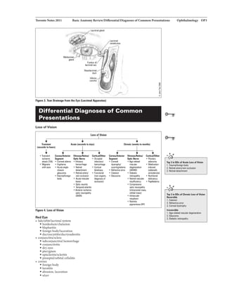 'IbroDloNota2011
Figure 3. Tear from tlte Eye (Lacllmal Appai'BIUI)
Differential Diagnoses of Common
Presentations
Loss ofVIsion
l.olsDIV1111111
ildanic
lllack(1IAl
• Mi!Pine
wilhl!ln
-+
CGmlllr/AIQdor
.......
• CCIIMII ed111111
• Al:uiiiii"Qkt-
closlUI
glaucoma
body
Figu111 4. Laa IfVilian
Red Eye
• llda/orbJ.tllacrlmalsystem
• hordeolum/chalazion
• blepharitis
• foreign body/laceration
Vlhaur/RIIIul
GpticiiMvll
• V"llnlous
t.n.lrrlwgl
• llll!illll
delactment
• Relilll nrd
veinoccUiion
• Acdii'IIIICU..
leeion
• Opti: rJIIWitis
• Tanporalal1aritis
• AnbnJrischanic
opticI1IIUtllll1hY
tAlON)
• dacryocystitis/dacryoadenitis
• COD:lunctivalsclera
• subconjunctivalhemorrhage
• conjunctivitis
• dryeyes
• pterygium
• episcleritisJscleritis
• preseptallorbltal celluliti&
• cornea
• foreign body
• keratitis
• abrasion,laceration
• ulcer
I
+
CarllcaWiher
• Occptal
irfarctiorV'
t.n.lrrlwgl
• Cortieal
bbtlaas
• Flllc1ionlll
(11011-IJIIIMie.
di'IIJ!Diisaf
IDWiln)
-+
....d
• Cornell
l11:811'ircVed111111
• llllfnlcliVIerrar
• l:allnllt
• Glaucoma
Gplii:NIIrw
• Aclt-l'llded
.,...
degenenilion
• Diablltic
• RJilal'IIISCU..
iraltliciency
+
CarllcaWiher
• PiluilaJy
ldanDma
ntur:lld
(lid.,.
ll!liodarcne)
• M.ltritional
dalicimcy
• l'aDilllldllml
opliclllllrapathy
(inlrlcllnialman,
01bi1111111111)
naaplum
• Rllililil
pQr!'entola(RP)
Ophthalmology OP3
,,,
Top lin DIJJItfAcull l.asaGfVIIItn
1. Tr..ruw'furaign bod'f
2. Ralillll.my/winIICCUion
3. Ralilllldlllllclrnent
,, ,
,.
'lb'S11 DDxofC...,. l.asiGfVIIIIn
lllvenillll
I.Catnct
2.R!lilactive lrrGI
3. Comaal dystrophy
lrraRni.la
1.Agt-ralalld macular
2. Glaucol'lll
3. Dilbatic rstiriiJIIIIIhy
 