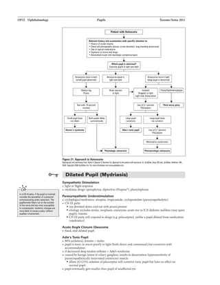 OP32 Ophthalmology
.... ,
..
In a CN Ul palsy, ifthe pupil is involved,
considartha possibility of apostarior
communiCIIIing army .,eurysm. The
pupillomotorfibenl run on the outside
ofthe nerve and an most susceptible
to compression. Ischemic changes are
men liUiy to ceun apalsywithout
pupillary involvement.
Pupils Toronto Notes 2011
Relevant hi.tory and llllllminalion with specific .ttention to:
• History of oculartrauma
• Checkold photiJvraphs (ptosis, ocular deviation, long st.-,ding anisocoria}
• Use of topical medications
• Exposn to toxins and drugs
• Associated ocularand neurologic symptDm.tsigns
Phpiolagic anilacoria
Figura 21. Approa.:h to Aniso.:oria
Mthpenrissillnfrom: Ked1rS. BiausseV, Newrr11n Ill!beprlienrwilllllliRM:olil. In:UpToDI!e.llose. BD ledl UpTolllte,Wlllthun,MA.
2008. Copyright2008 UpTolliiB,Inc. FG!mcn infarmlllionvisitwww.uptodllll.com.
Dilated Pupil (Mydriasis)
Sympathetic Stimulation
• fight or flight response
• mydriatic drugs: epinephrine. dipivefrin (Propine•), phenylephrine
Parasympathetic Understimulation
• cycloplegics/mydriatics: atropine. tropicamide, cyclopentolate (parasympatholytic)
• CN III palsy
• eye deviated down and out with ptosis present
• etiology includes stroke, neoplasm, aneurysm, acute rise in ICP, diabetes mellitus (may spare
pupil), trauma
• CN III palsywill respond to drugs (e.g. pilocarpine}, unlike a pupil dilated from medication
(rnydriatics)
Acute Angle Closure Glaucoma
• fixed, mid-dilated pupil
Adie's Tonic Pupil
• 80% unilateral, females > males
• pupil is tonic or reacts poorly to light (both direct and consensual) but constricts with
accommodation
• ifdecreased deep tendon reflexes = Adie's syndrome
• caused bybenign lesion in ciliary ganglion; results in denervation hypersensitivity of
parasympatheticallyinnervated constrictor muscle
• dilute (0.125%) solution ofpilocarpine will constrict tonic pupil but have no effect on
normal pupil
• pupil eventuallygets smaller than pupil ofunaffected eye
 