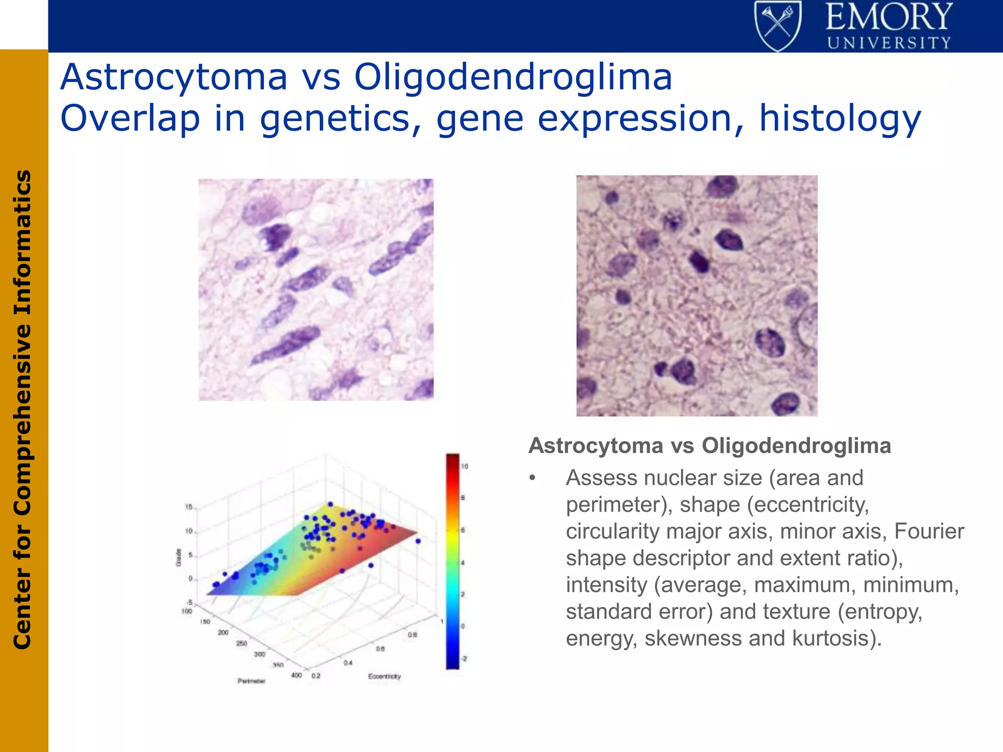 Astrocytoma vs Oligodendroglima
                                       Overlap in genetics, gene expression, histology
Center for Comprehensive Informatics




                                                                Astrocytoma vs Oligodendroglima
                                                                • Assess nuclear size (area and
                                                                   perimeter), shape (eccentricity,
                                                                   circularity major axis, minor axis, Fourier
                                                                   shape descriptor and extent ratio),
                                                                   intensity (average, maximum, minimum,
                                                                   standard error) and texture (entropy,
                                                                   energy, skewness and kurtosis).
 