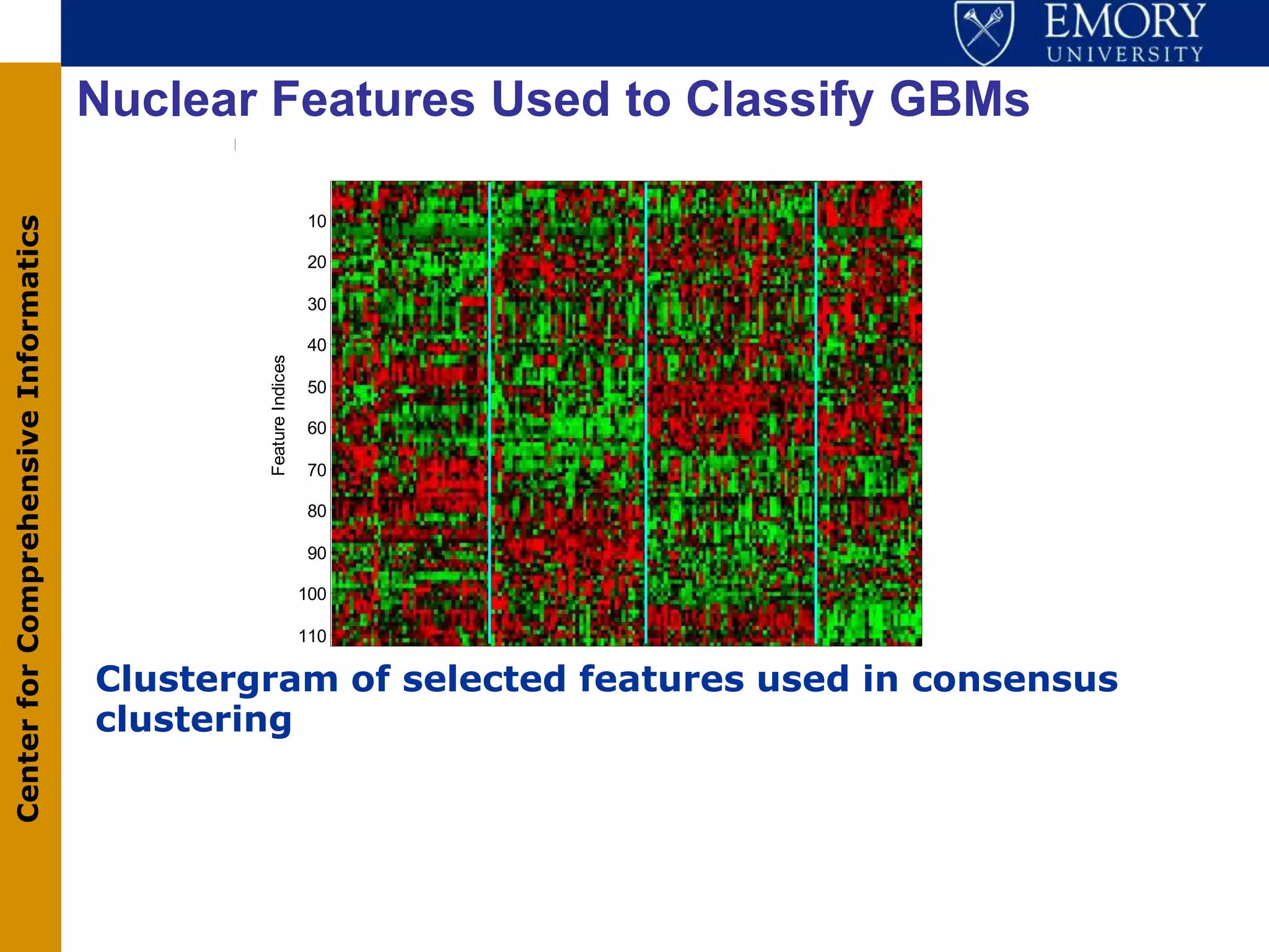 Nuclear Features Used to Classify GBMs

                                                                 10
Center for Comprehensive Informatics




                                                                 20

                                                                 30

                                                                 40
                                               Feature Indices




                                                                 50

                                                                 60

                                                                 70

                                                                 80

                                                                 90

                                                                 100

                                                                 110

                                       Clustergram of selected features used in consensus
                                       clustering
 