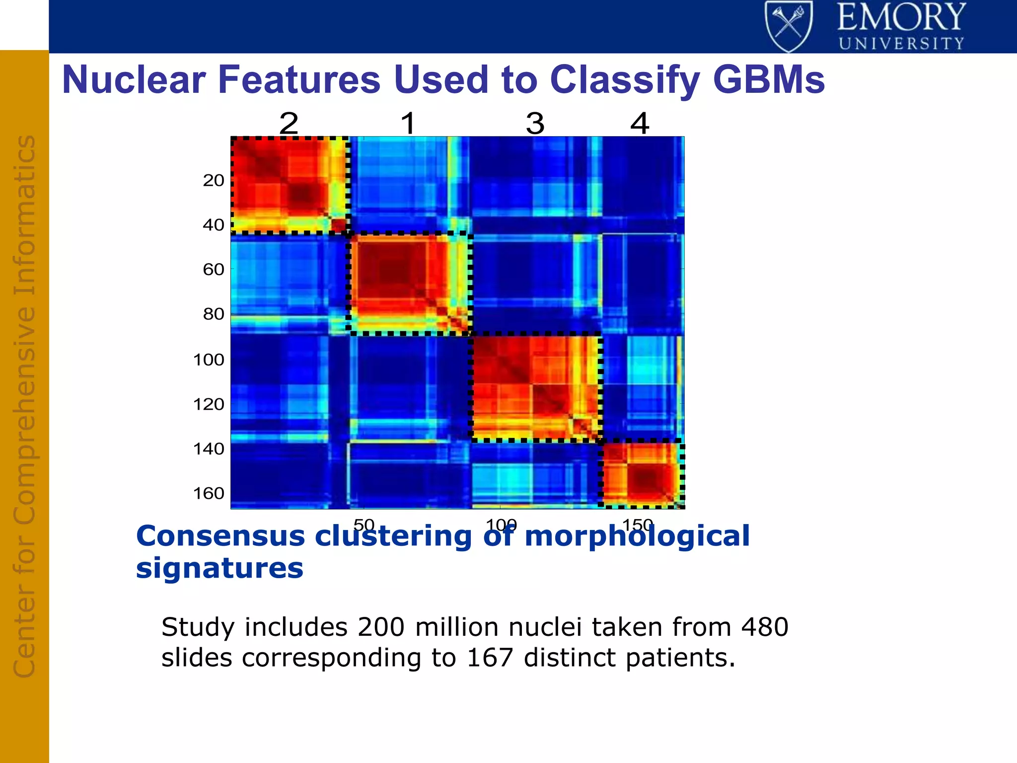 Nuclear Features Used to Classify GBMs
                                                   2          1          3    4
Center for Comprehensive Informatics




                                                                                                    1
                                              20

                                              40

                                              60
                                                                                                    2




                                                                                          Cluster
                                              80

                                             100

                                                                                                    3
                                             120

                                             140

                                             160                                                    4

                                          Consensus clustering of morphological
                                                         50        100        150
                                                                                                        0   0.2      0.
                                          signatures                                                              Silho


                                           Study includes 200 million nuclei taken from 480
                                           slides corresponding to 167 distinct patients.
 