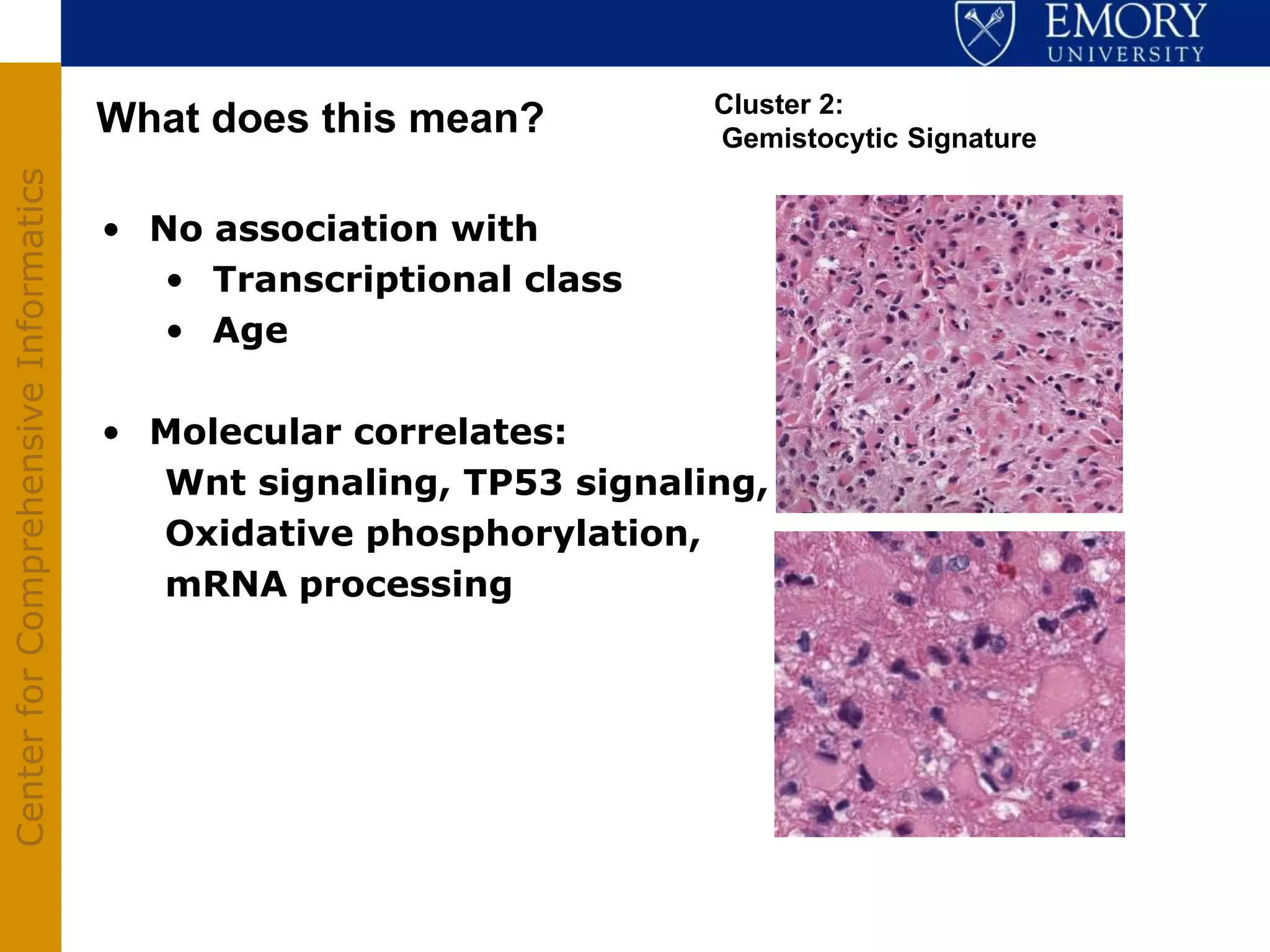 Cluster 2:
                                       What does this mean?         Gemistocytic Signature
Center for Comprehensive Informatics




                                       • No association with
                                          • Transcriptional class
                                          • Age

                                       • Molecular correlates:
                                         Wnt signaling, TP53 signaling,
                                         Oxidative phosphorylation,
                                         mRNA processing
 