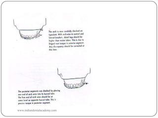 Checking the
amount of torque

www.indiandentalacademy.com

 