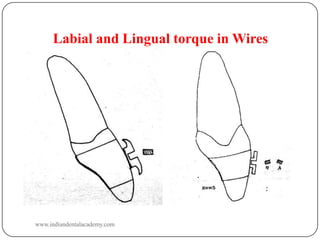 Labial and Lingual torque in Wires

www.indiandentalacademy.com

 