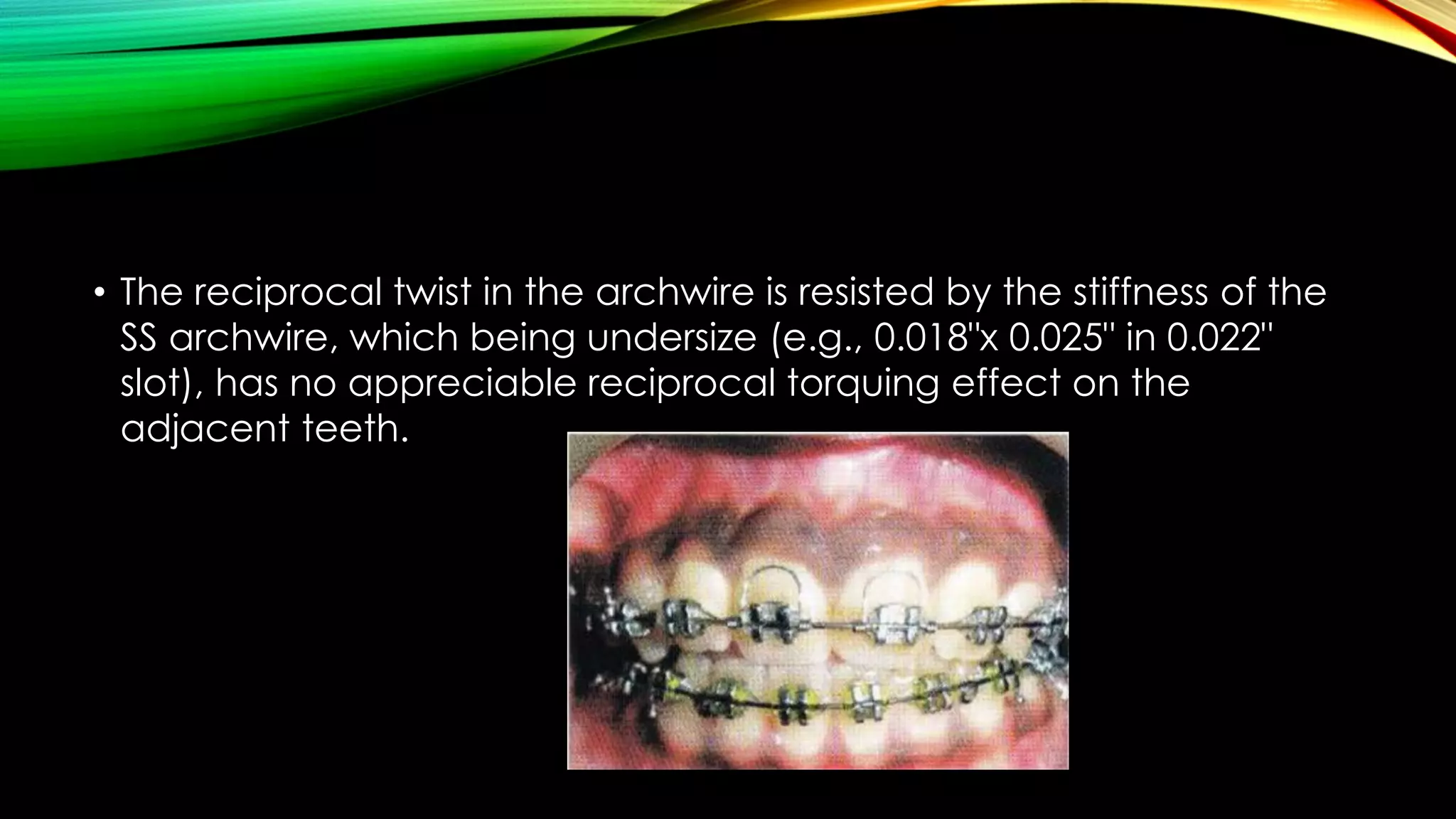 Reciprocal Tooth The Root Torqueing Auxiliaries in Orthodontics | PDF