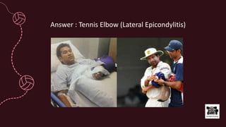 Answer : Tennis Elbow (Lateral Epicondylitis)
 
