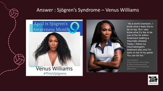 Answer : Sjögren’s Syndrome – Venus Williams
 