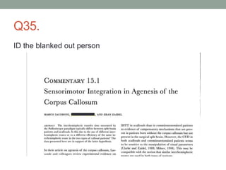 Q35.
ID the blanked out person
 