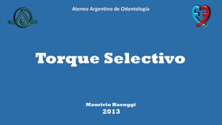 Torque Selectivo
Mauricio Haenggi
2013
Ateneo Argentino de Odontología
 