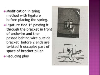  Modification in tying
method with ligature
before placing the spring.
 Ligature tied 1st passing it
through the bracket in front
of archwire and then
passed behind wire outside
bracket before 2 ends are
twisted & occupies part of
space of bracket pillar.
 Reducing play
 
