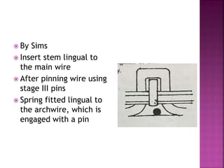  By Sims
 Insert stem lingual to
the main wire
 After pinning wire using
stage III pins
 Spring fitted lingual to
the archwire, which is
engaged with a pin
 