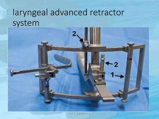 laryngeal advanced retractor
system
Prof. S. Subbiah et al
 