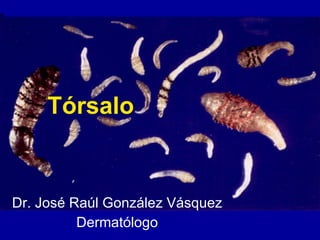Tórsalo Dr. José Raúl González Vásquez Dermatólogo 