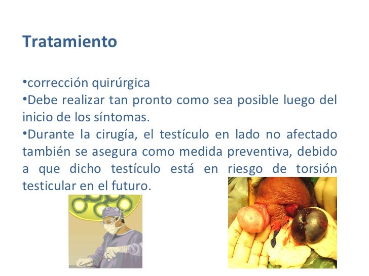 Torsion testicular