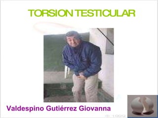TORSION TESTICULAR  Valdespino Gutiérrez Giovanna   
