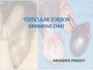 TESTICULAR TORSION
OPERATIVE CHAT
- ABHISHEK PANDEY
 