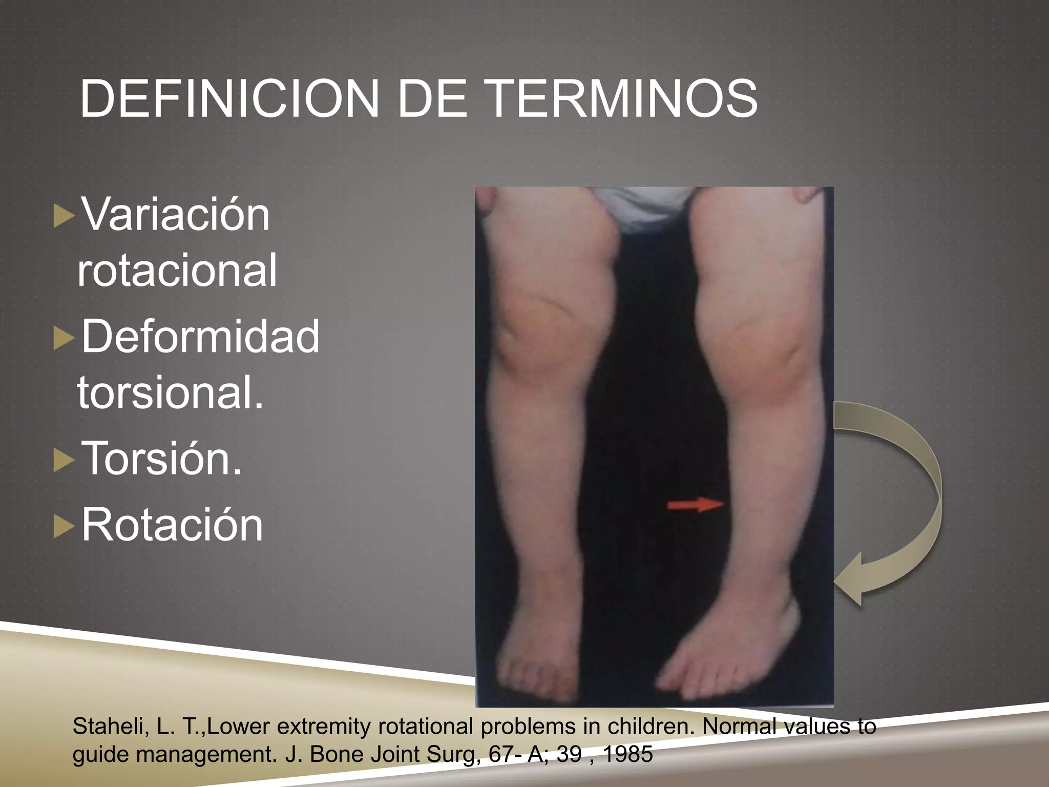 Torsion tibial | PPTX