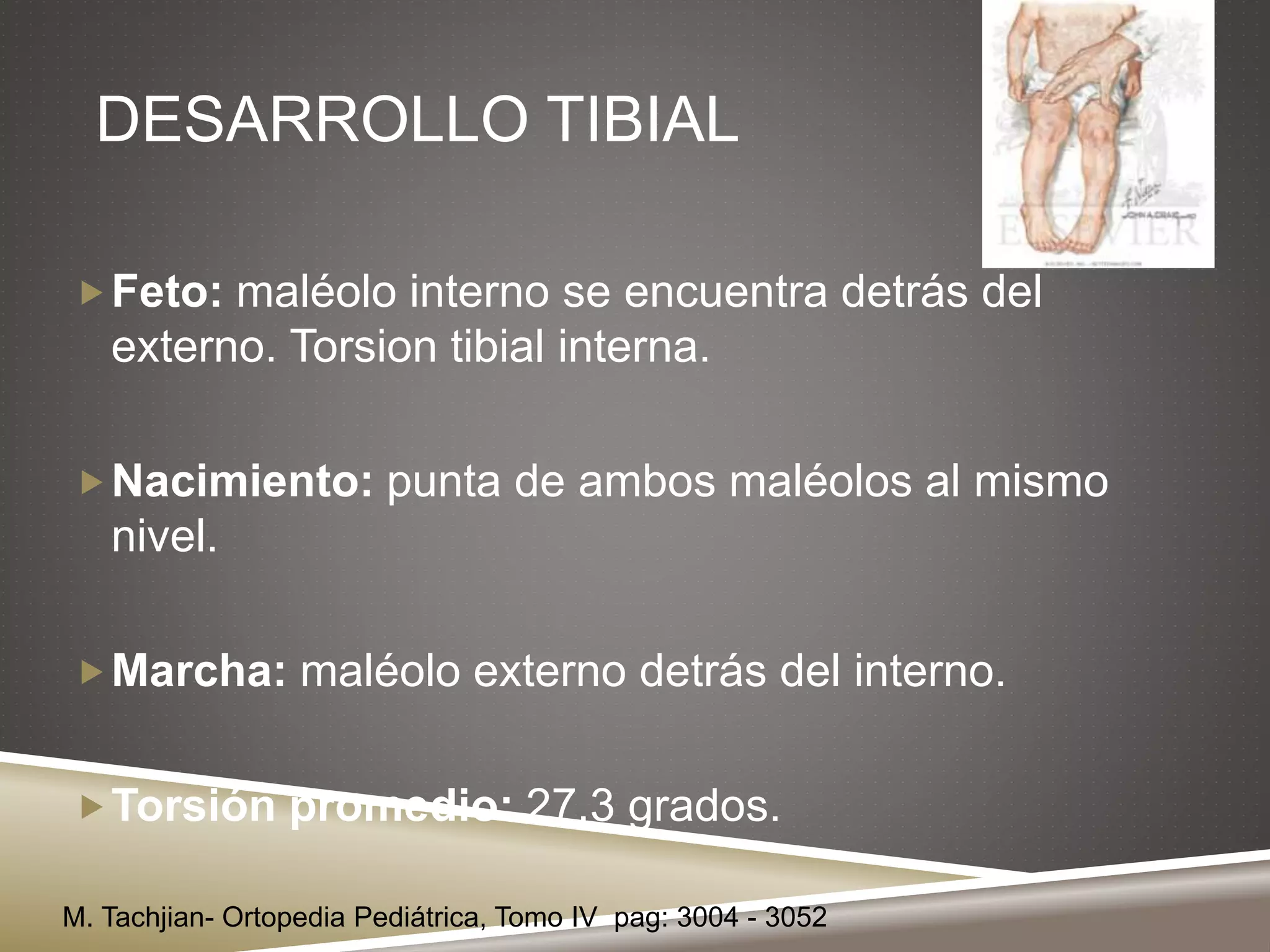 Torsion tibial | PPTX