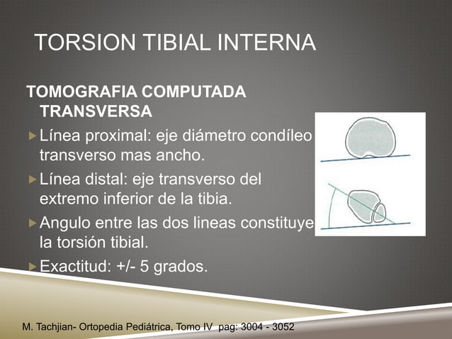 Torsion tibial | PPTX