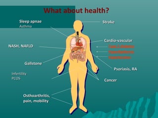 Sleep apnaeSleep apnae
AsthmaAsthma
NASH, NAFLDNASH, NAFLD
Cardio-vascularCardio-vascular
Type 2 diabetes
Hyperlipidemia
Hypertension
InfertilityInfertility
PCOSPCOS
Osthoarthritis,Osthoarthritis,
pain, mobilitypain, mobility
GallstoneGallstone
CancerCancer
What about health?
StrokeStroke
Psoriasis, RAPsoriasis, RA
 