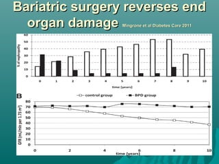 Bariatric surgery reverses endBariatric surgery reverses end
organ damageorgan damage Mingrone et al Diabetes Care 2011Mingrone et al Diabetes Care 2011
 