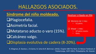 HALLAZGOS ASOCIADOS.
Plagiocefalia.
Asimetría facial.
Metatarso aducto o varo (15%).
Calcáneo valgo.
Displasia evolutiva de cadera (8-20%).
R. Kliegman, B. Stanton, J. St Geme, N. Schor & R. Behrman. (2016). Chapter 680 The Neck. En Nelson Textbook of
Pediatrics(pp. 3297-3301). Philadelphia, PA: Elsevier.
Síndrome del niño moldeado. Realizar cribado en RN:
 Menores de 1 mes:
• US pelvis.
 Mayor 1 mes:
• AP pelvis neutra.
• Rana.
 