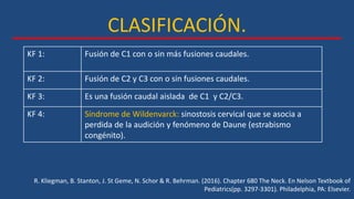 CLASIFICACIÓN.
R. Kliegman, B. Stanton, J. St Geme, N. Schor & R. Behrman. (2016). Chapter 680 The Neck. En Nelson Textbook of
Pediatrics(pp. 3297-3301). Philadelphia, PA: Elsevier.
KF 1: Fusión de C1 con o sin más fusiones caudales.
KF 2: Fusión de C2 y C3 con o sin fusiones caudales.
KF 3: Es una fusión caudal aislada de C1 y C2/C3.
KF 4: Síndrome de Wildenvarck: sinostosis cervical que se asocia a
perdida de la audición y fenómeno de Daune (estrabismo
congénito).
 