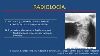 RADIOLOGÍA.
R. Kliegman, B. Stanton, J. St Geme, N. Schor & R. Behrman. (2016). Chapter 680 The Neck. En Nelson Textbook of
Pediatrics(pp. 3297-3301). Philadelphia, PA: Elsevier.
 AP, lateral y oblicua de columna cervical.
• Fusión de 2 o más cuerpos vertebrales.
 Proyecciones laterales en flexión-extensión.
• Identificación de segmentos con exceso de
movilidad.
 