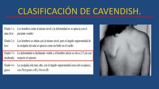 CLASIFICACIÓN DE CAVENDISH.
 