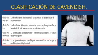 CLASIFICACIÓN DE CAVENDISH.
 
