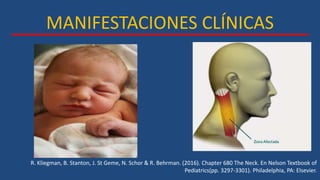 MANIFESTACIONES CLÍNICAS
R. Kliegman, B. Stanton, J. St Geme, N. Schor & R. Behrman. (2016). Chapter 680 The Neck. En Nelson Textbook of
Pediatrics(pp. 3297-3301). Philadelphia, PA: Elsevier.
 