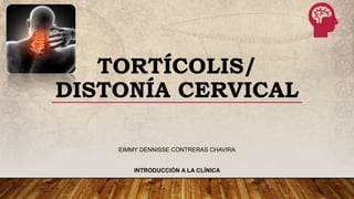 TORTÍCOLIS/
DISTONÍA CERVICAL
EIMMY DENNISSE CONTRERAS CHAVIRA
INTRODUCCIÓN A LA CLÍNICA
 
