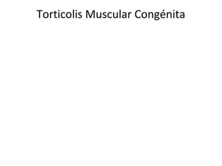 Torticolis Muscular Congénita
 