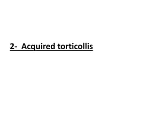 2- Acquired torticollis
 
