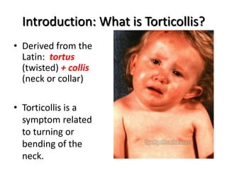 Introduction: What is Torticollis?
• Derived from the
Latin: tortus
(twisted) + collis
(neck or collar)
• Torticollis is a
symptom related
to turning or
bending of the
neck.
 