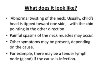 What does it look like?
• Abnormal twisting of the neck. Usually, child’s
head is tipped toward one side, with the chin
pointing in the other direction.
• Painful spasms of the neck muscles may occur.
• Other symptoms may be present, depending
on the cause.
• For example, there may be a tender lymph
node (gland) if the cause is infection.
 