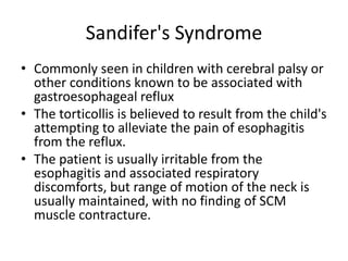 Sandifer Reflex Torticollis | PPTX