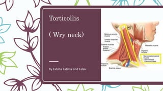 Torticollis
( Wry neck)
By Fabiha Fatima and Falak.
 