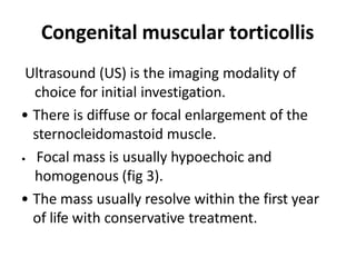 Congenital muscular torticollis
Ultrasound (US) is the imaging modality of
choice for initial investigation.
• There is diffuse or focal enlargement of the
sternocleidomastoid muscle.
• Focal mass is usually hypoechoic and
homogenous (fig 3).
• The mass usually resolve within the first year
of life with conservative treatment.
 