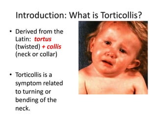 • Derived from the
Latin: tortus
(twisted) + collis
(neck or collar)
• Torticollis is a
symptom related
to turning or
bending of the
neck.
 